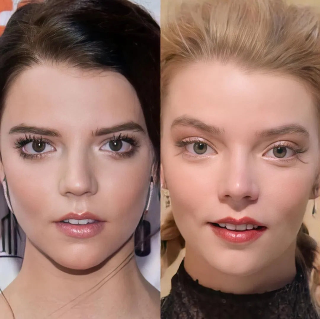 Types of Eyelid Surgery