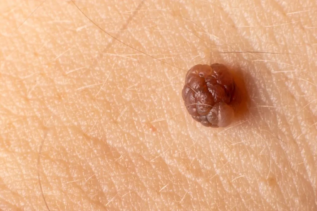 Blog Post Image