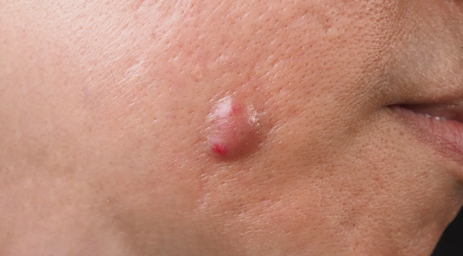 Blog Post Image