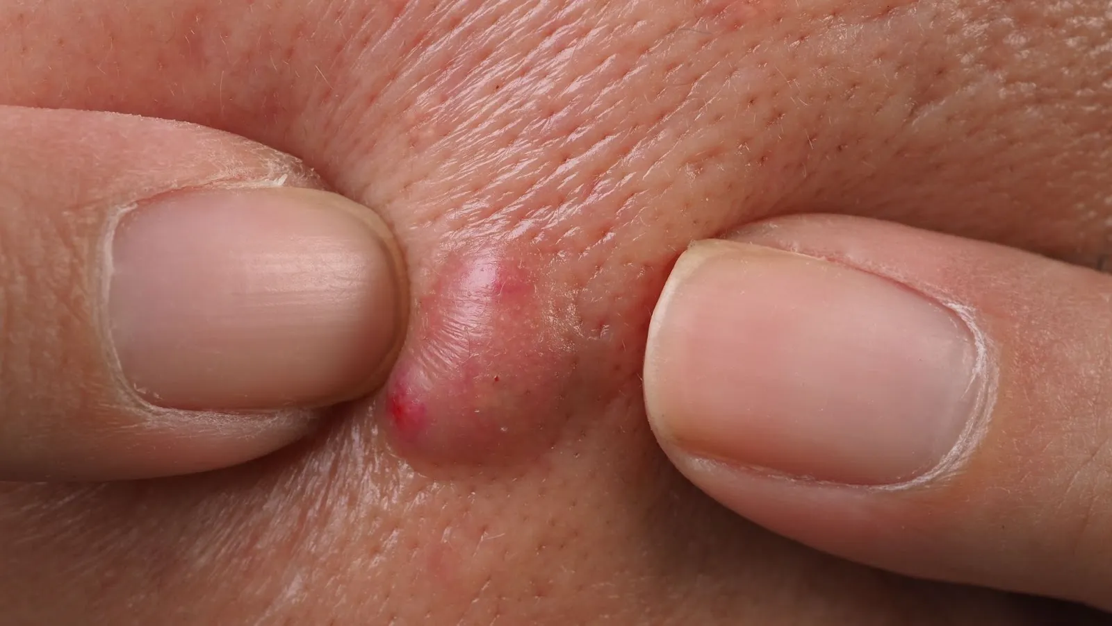 Blog Post Image