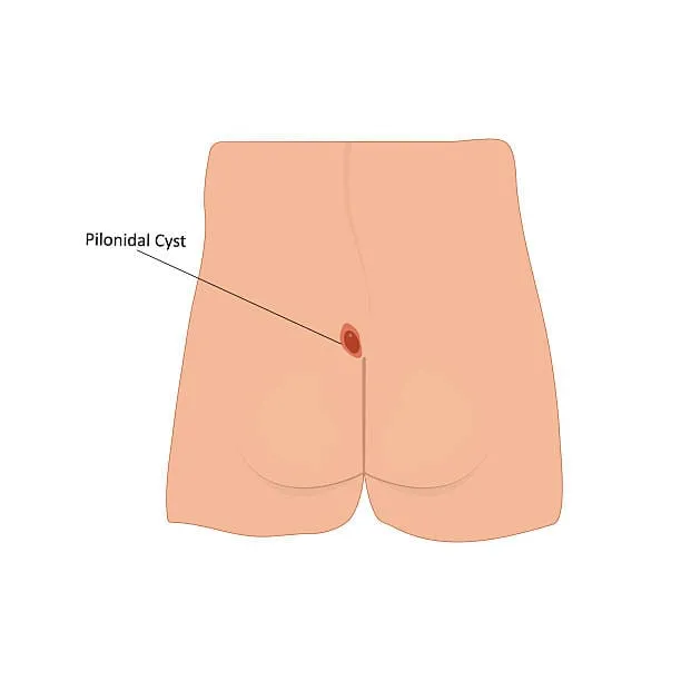 Blog Post Image