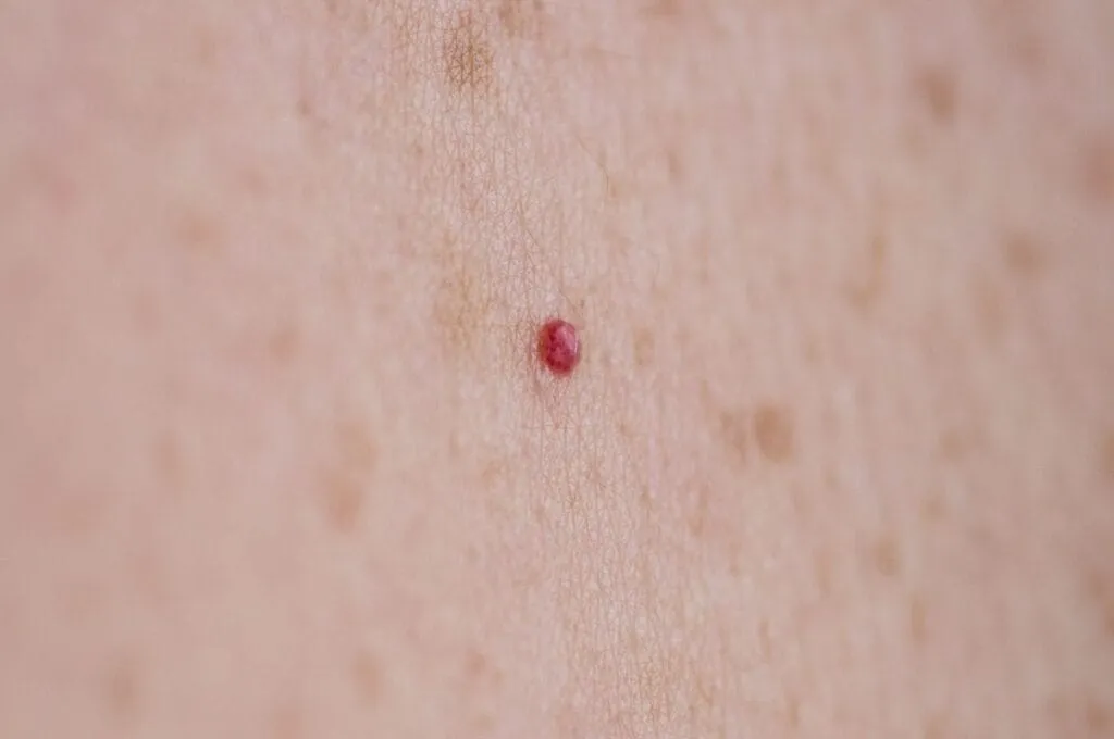 Blog Post Image
