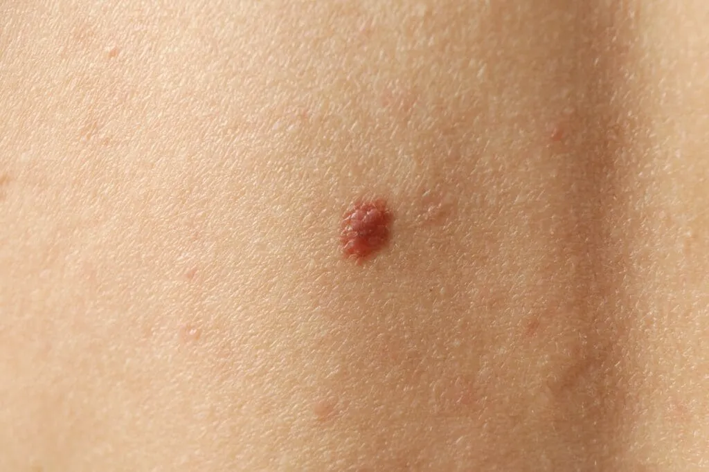 Blog Post Image