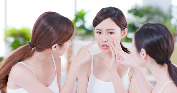 Facial Cyst Removal