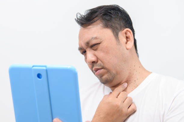Neck Skin Tag Removal