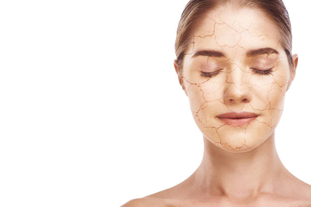 Skin Tag Removal Methods