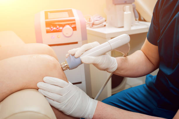 Cryotherapy Cyst Removal