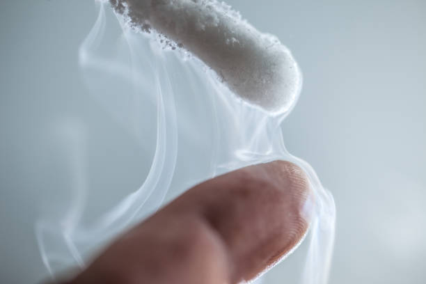 Cryotherapy Cyst Removal